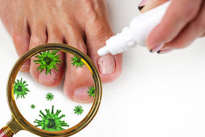 Anti Hongo ToenailPlus: Elimina Hongos